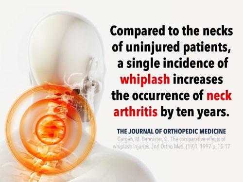 slide4-arthritis