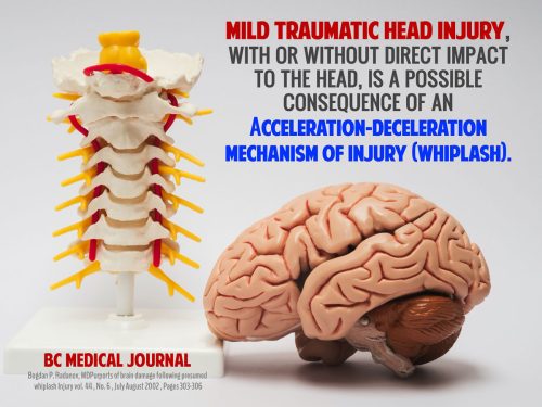 slide9-traumatic-head-injury